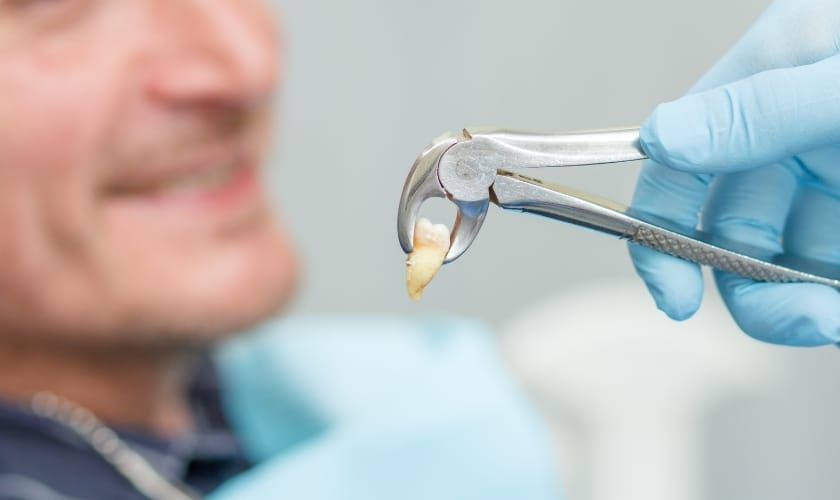 Tooth Extraction in Rancho Cucamonga, CA, Choice Family Dentistry Of Rancho Cucamonga