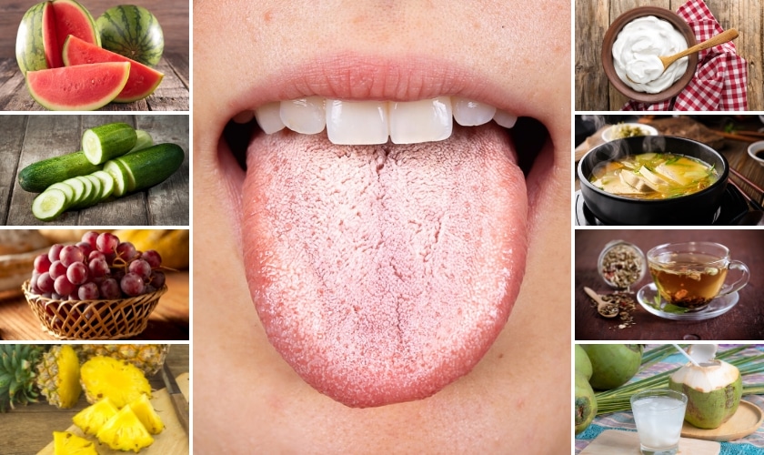 foods to eat when you have dry mouth
