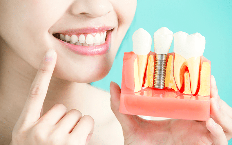 Dental Implants To Treat Speech Issues